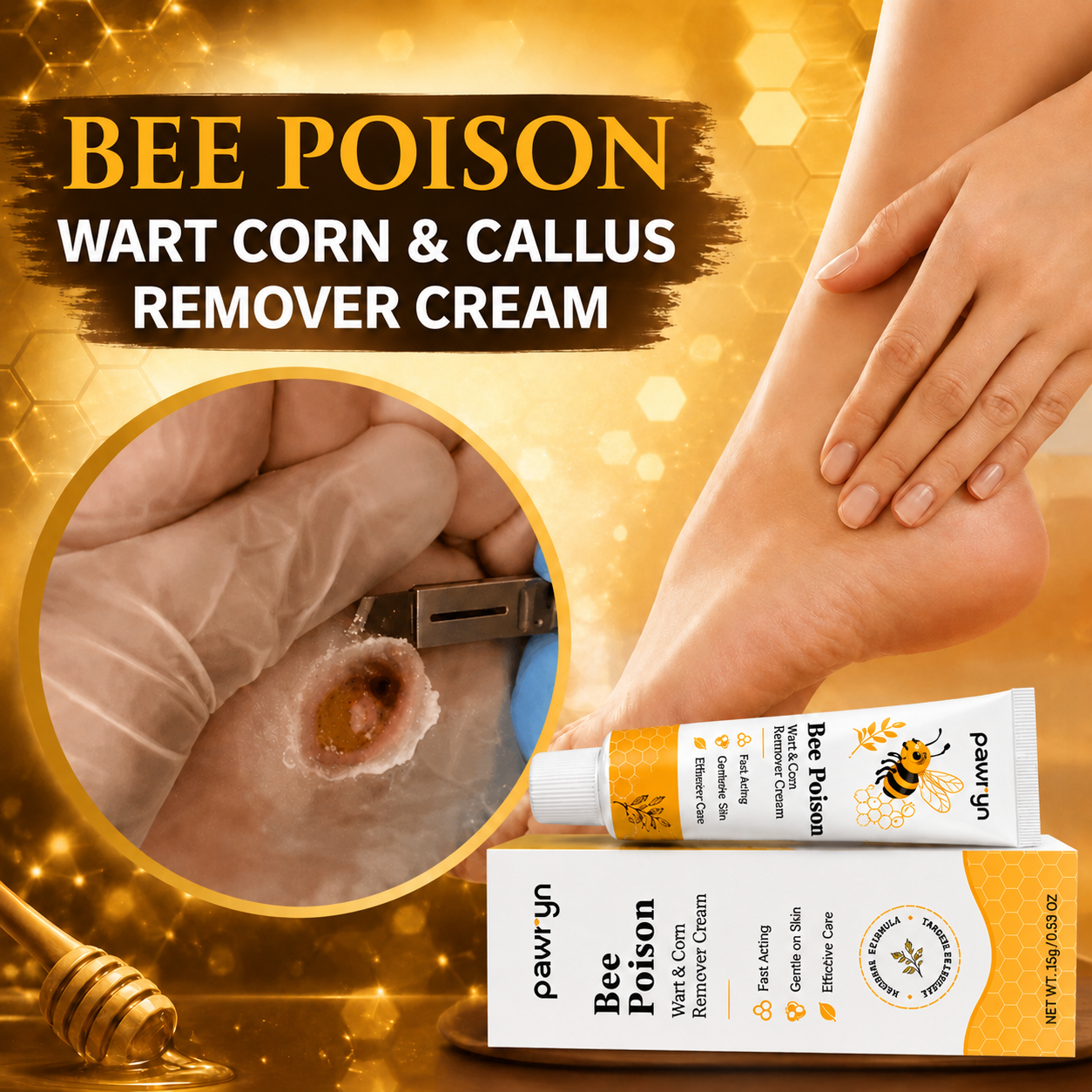 👨‍⚕️pawry-Bee Poison Wart & Corn Remover Cream⚡