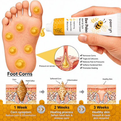 👨‍⚕️pawry-Bee Poison Wart & Corn Remover Cream⚡