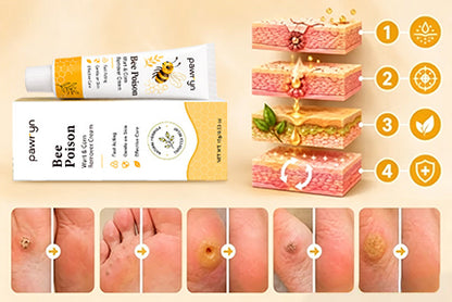 👨‍⚕️pawry-Bee Poison Wart & Corn Remover Cream⚡