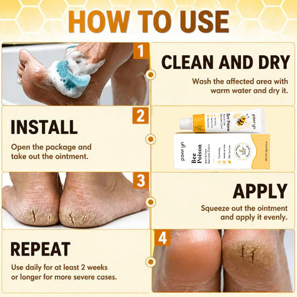👨‍⚕️pawry-Bee Poison Wart & Corn Remover Cream⚡