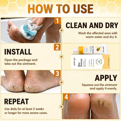 👨‍⚕️pawry-Bee Poison Wart & Corn Remover Cream⚡