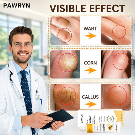 👨‍⚕️pawry-Bee Poison Wart & Corn Remover Cream⚡
